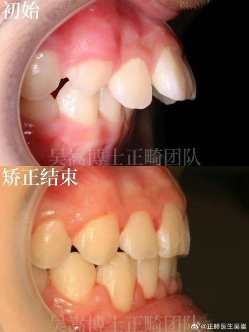 郑州植得口腔医院是国内连锁，实力强
