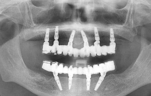 广州曙光口腔收费贵吗？其实价格合理，性价比高，能让你享受优质口腔医美服务 