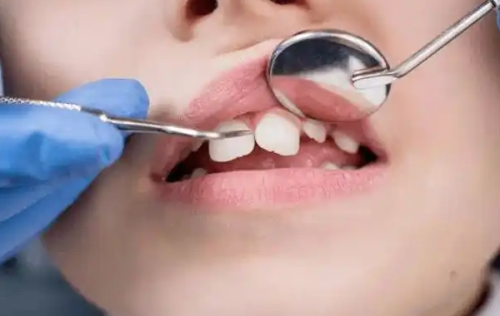 深圳格伦菲尔口腔医院：专精医生团队，技术保护