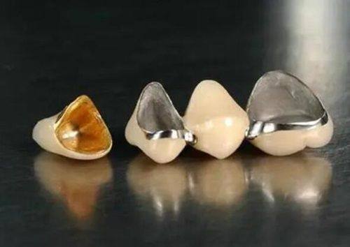 深圳格伦菲尔口腔医院：贴心服务与合理收费，赢得口碑