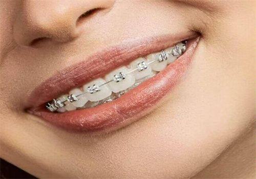 广州鼎植口腔坑不坑？真实体验揭秘，技术靠谱服务好，并非坑人机构！ 