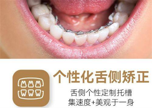 广州鼎植口腔医院的硬件设施与技术：精良智能助诊疗