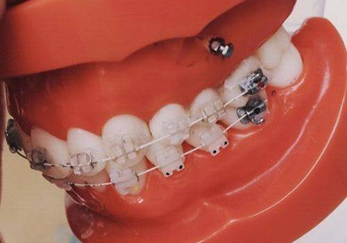 成都布莱梅联合口腔医院诊疗项目及特色技术