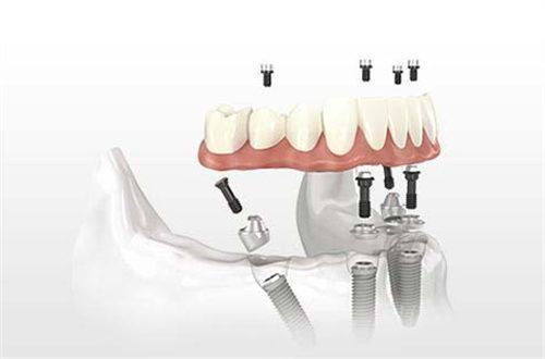 广州曙光口腔医院口碑情况分析