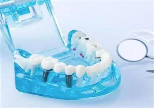 口碑对比:正恩口腔口碑良好,金科信息待查