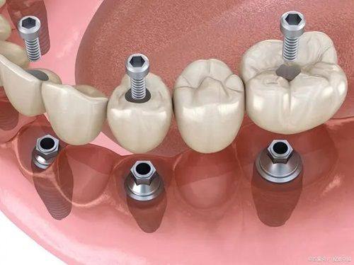 广州曙光口腔医院坑不坑?真实体验揭秘,看它在技术、服务和效果上到底靠不靠谱!