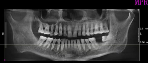 北京整齐娃娃口腔医院是不是正规医院？它有正规资质，医生靠谱技术好值得信赖
