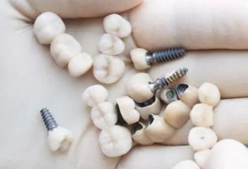 济南可恩口腔靠谱吗?正规连锁品牌，医生经验丰富技术好，口碑佳值得信赖 