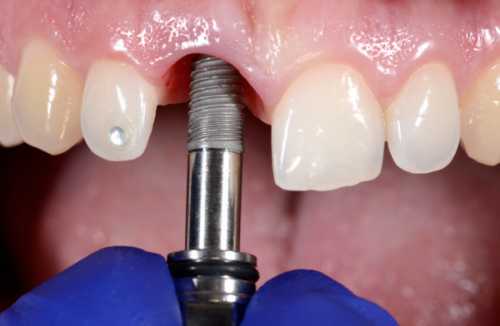 总结:综合考量,正恩口腔更具优势