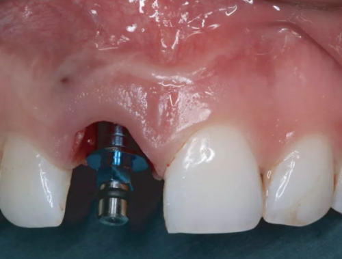 常州北极星口腔医院值得信赖吗？专业医生团队+先进设备，值得大家放心选择 