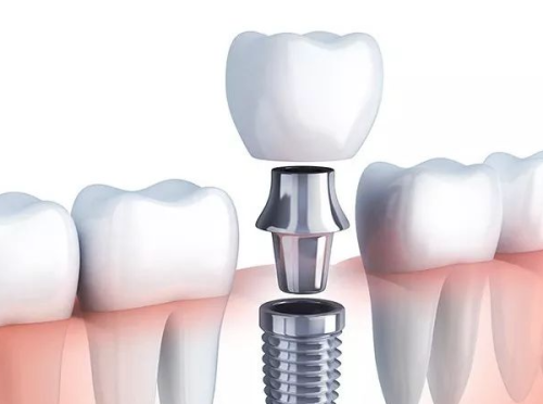 北京整齐娃娃口腔门诊怎么样？详细揭秘收费标准和用户真实评价