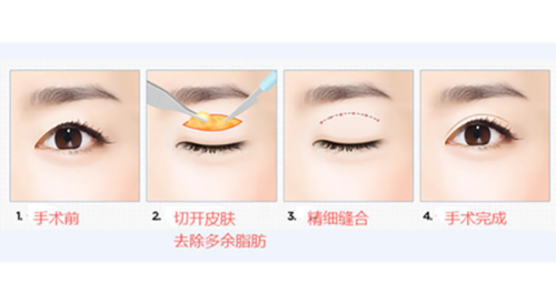 广州曙光口腔医院价格公开透明