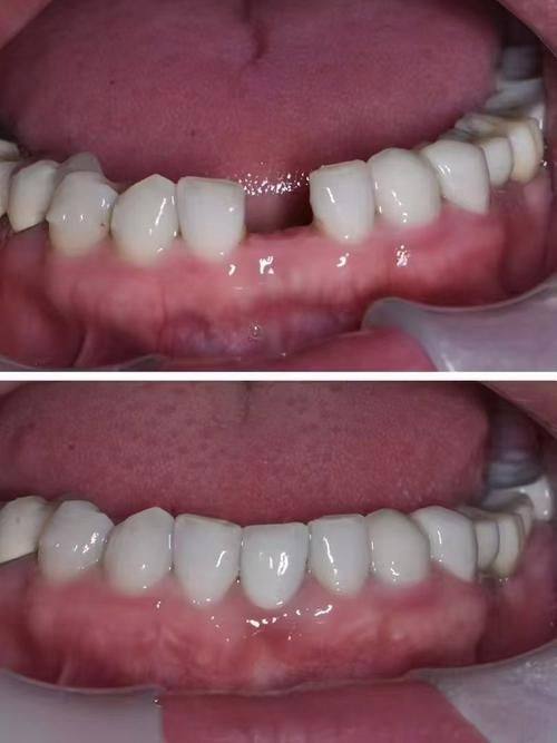 求告知广州曙光是公办还是私立医院?曙光口腔哪个医生做种植牙靠谱