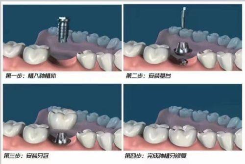 广州柏德口腔门诊部海珠院区的便捷到达路线及交通指南