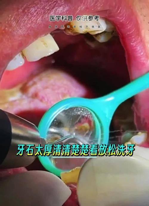 惠州深惠口腔门诊部怎么样?看患者口碑评价