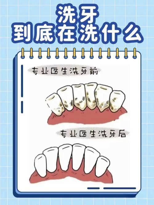 惠州深惠口腔门诊部收费贵吗?参考新版价格表