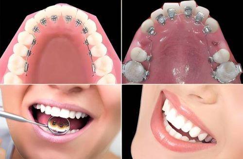 金华蓝芽口腔医院:医生经验多,技术不错