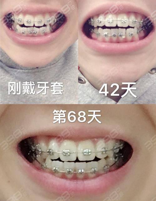 广州鼎植口腔医院的医生团队：实力雄厚技术强