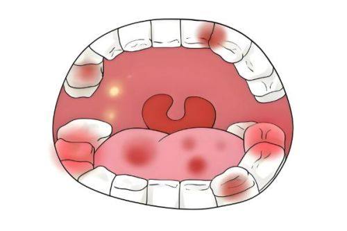 成都布莱梅联合口腔医院收费贵吗?其实价格合理,性价比高,值得大家放心选择