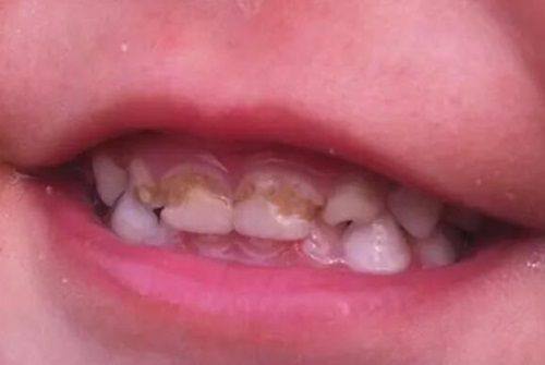 深圳新安麦芽口腔门诊部:精良高端的诊疗设备