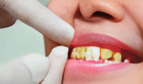 维乐口腔(32 城连锁)