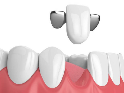 深圳格伦菲尔口腔医院价格合理,性价比高