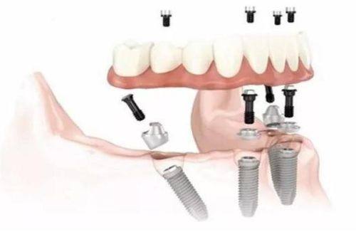 成都布莱梅联合口腔医院的性价比优势