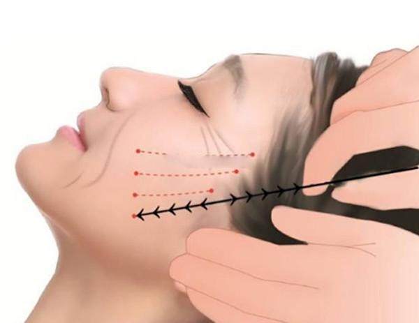 杜太超拉皮手术价格贵吗?从技术、效果和服务来看,这钱花得值不值你一看便知