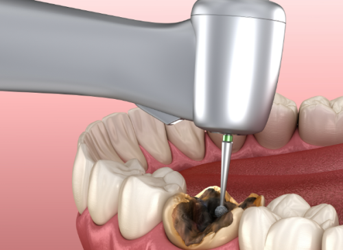 宜昌爱合口腔医院是几级医院？二级专科实力不凡