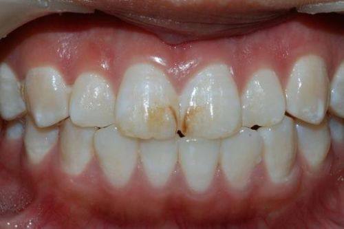 深圳格伦菲尔口腔医院的医生团队：经验多，专精可靠