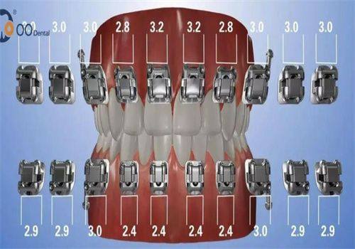 贵港佳士洁口腔门诊部：牙齿矫正成效显著，个性化方案贴心