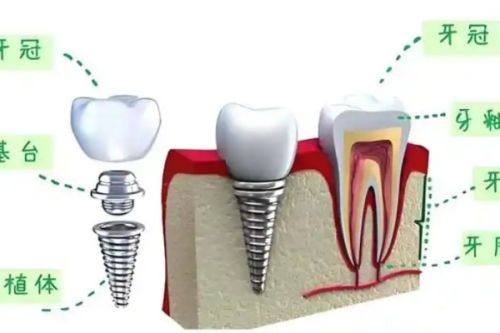 北京牙元素口腔医院靠谱吗?资质、医生、技术设备全揭秘