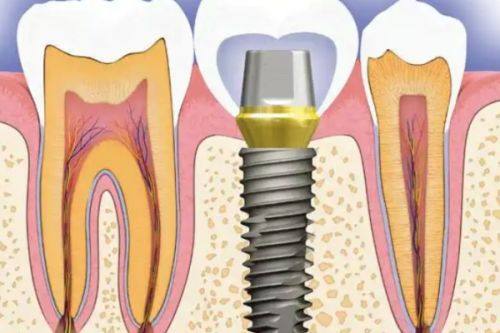 广州曙光口腔医院:患者真实经历与靠谱分析
