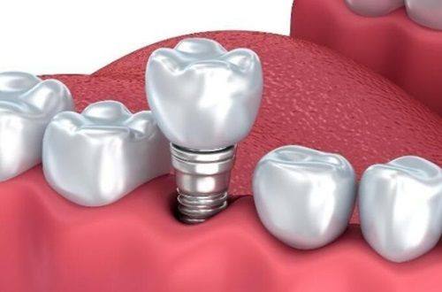 成都新桥口腔医院是私立医院吗?虽是私立但口碑爆棚的正规牙科连锁!