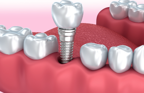 北京牙元素口腔收费贵吗？实际收费与服务质量匹配，性价比高低一看便知 