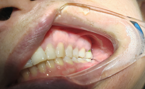 南宁蓝天口腔医院：收费透明合理