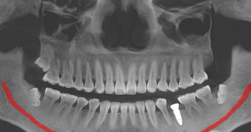 北京维乐口腔好不好？多院区合规备案+技术优服务佳+用户好评，值得考虑!
