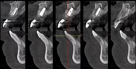 北京维乐口腔医院是正规医院吗？医院资质+技术优势+分院布局及患者体验分析