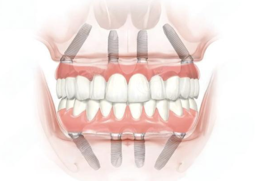 成都新桥口腔医院是不是正规医院？它是正规口腔医院，牙科项目靠谱值得信赖 