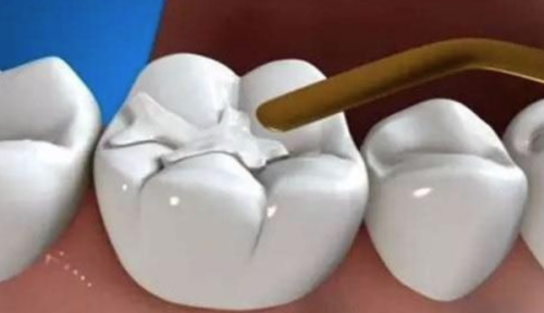 患者真实评价上海皓麒口腔门诊部