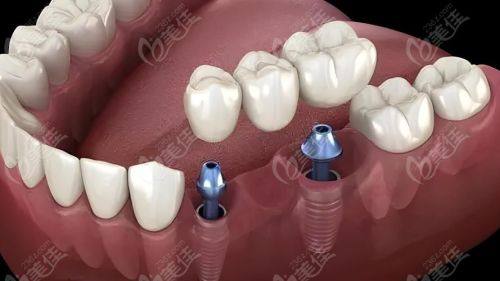 徐州瑞博医院口腔科的优势亮点