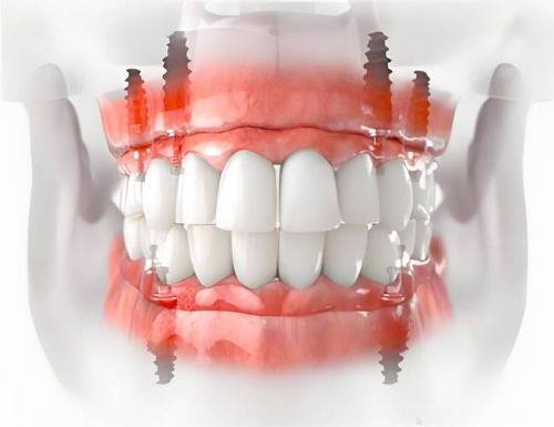 北京牙元素口腔医院可靠吗?可靠,它是正规牙科技术和口碑都不错