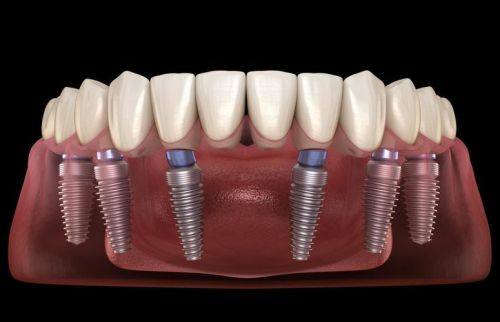 北京牙元素口腔评价口碑怎么样？真实患者反馈揭秘，这家口腔机构值得信赖吗？ 