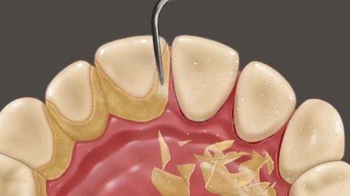 徐州爱牙口腔医院的其他医美牙齿项目：满足多样需求