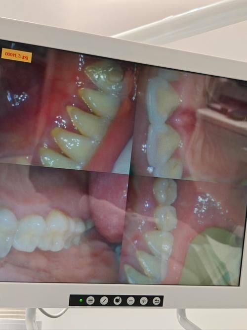 贵阳利美康口腔(金阳分院)的合理收费体系