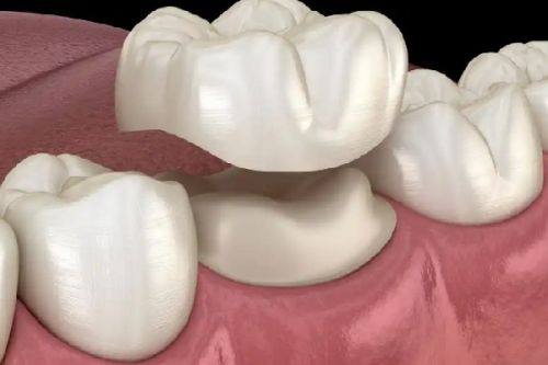 长沙中诺口腔医院口碑评价好不好？真实患者反馈揭秘，技术服务双优值得信赖