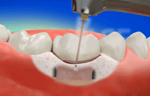 佛山万国口腔医院:设备精良助诊疗