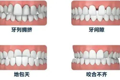 云南昆明松鼠口腔医院牙齿矫正收费情况