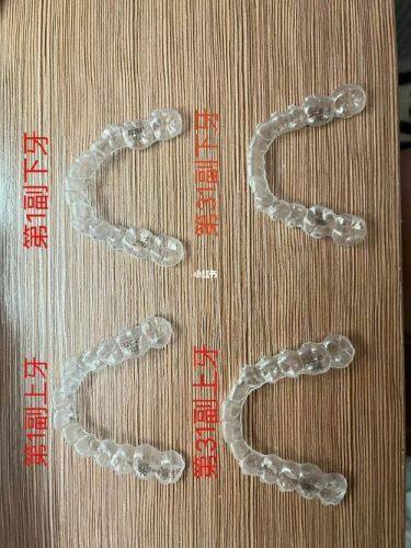 广州穗华口腔医院收费标准咋样？价格合理项目丰富，让你看牙无负担！ 