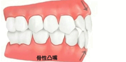 重庆团圆口腔医院:价格透明合理